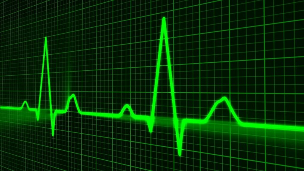 Green graph and black background