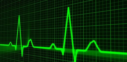 grafico verde e sfonda nero