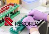 OPA Recordati: conviene aderire? Focus su prezzo azioni ricerca farmaceutica